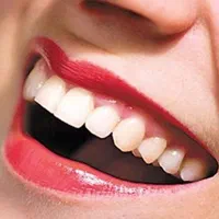 دندانسازی صدف با ۴۰ سال تجربه