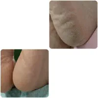 پدیکور و کفسابی 350 فیشیال و پاکسازی پوست 200