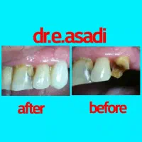 دندانپزشکی و زیبایی لبخند، تعرفه دولتی|خدمات آرایشگری و زیبایی|تهران, جمالزاده|دیوار