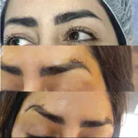 جراحی زیبایی لیپوساکشن لیفت سینه