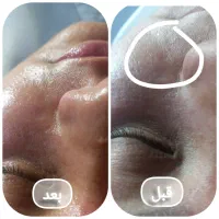 پاکسازی رایگان|خدمات آرایشگری و زیبایی|مشهد, ایثار|دیوار