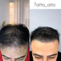 میکروابرو/میکرواسکالپ/‌رفع تیرگی لب/تتوبدن/کاورتتو|خدمات آرایشگری و زیبایی|شاهین‌شهر, حافظ شمالی|دیوار