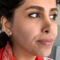 تزریق ژل و بوتاکس، لیزر ،هایفو اندولیفت فیلر بادی