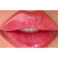تزریق بوتاکس، ژل، مزوتراپی، خالبرداری در مطب پزشک|خدمات آرایشگری و زیبایی|مشهد, رسالت|دیوار
