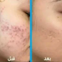 سلام روغن های خوراکی ورق بزنید|آرایشی، بهداشتی، درمانی|محمدیه-قزوین, |دیوار