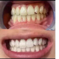خدمات دندانپزشکی با اقساط