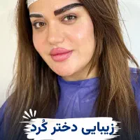 تخفیفات ویژه کاشت ابرو تا ۷تیر ماه