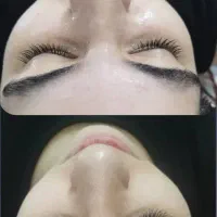 پاکسازی حرفهای پوست با فیشال کلاسیک