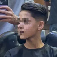 مدل فید صفر یا بازکات