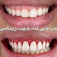 دندانپزشکی و دندان سازی خیریه چمران (جراحی. زیبایی