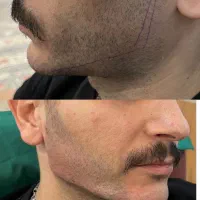 خدمات تزریق ژل و بوتاکس|خدمات آرایشگری و زیبایی|مشهد, عسگریه|دیوار