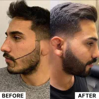سرم سیر سیاه