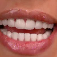 کامپوزیت دندان،اف ار سی، روکش ،با ضمانت نامه کتبی|خدمات زیبایی و سلامت|کرج, عظیمیه|دیوار