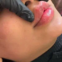 فیلر لب روسی عروسکی|خدمات آرایشگری و زیبایی|سلماس, |دیوار