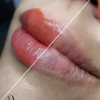 تخفیف میکروبلیدینگ و شیدینگ لب|خدمات آرایشگری و زیبایی|فولادشهر, B4|دیوار