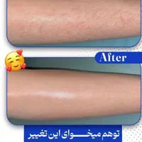 لیزر موج کندلا لیزر آقایان لیزر بانوان|خدمات آرایشگری و زیبایی|اصفهان, نقش جهان|دیوار