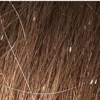 شپش|آرایشی، بهداشتی، درمانی|کاشان, کارگر|دیوار