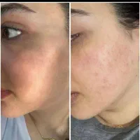 سفید برفی شو|آرایشی، بهداشتی، درمانی|اهواز, امانیه|دیوار