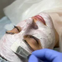 انجام خدمات پوستی فقط وفقط۳۰۰ به مدت محدود