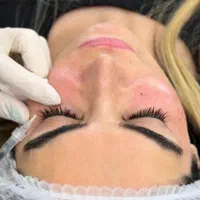 تزریق ژل بوتاکس مزوتراپی پاکسازی جوانسازیی