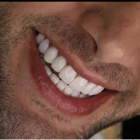 دندانسازی اقساطی دندان مصنوعی بهترین کیفیت