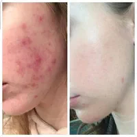 کرم سرم روشن کنند قوی  صورت دست پا اوین عمده وتک