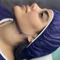 مرکز تخصصی ساکشن غبغب((دائمی))