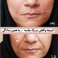 مطب دکتر پاک منش|خدمات آرایشگری و زیبایی|بهبهان, |دیوار