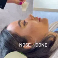 جراحی بینی فقط ۸و۹ آذر فقط۲۹ میلیون تومان|خدمات آرایشگری و زیبایی|فریدونشهر, |دیوار