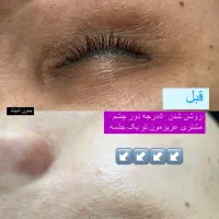 پاکسازی صورت ۲۵۰ تومن|خدمات آرایشگری و زیبایی|لاهیجان, کوی استادان|دیوار