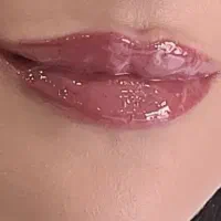 بوتاکس فیلر خالبرداری لاغری‌ مزوتراپی