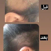 کرم سفید کننده صورت وبدن 10درجه سفیدی بدون بازگشت|آرایشی، بهداشتی، درمانی|کرمان, |دیوار