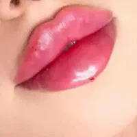 فیلر لیفت بینی و صورت وشقیقه مزوتراپی بوتاکس|خدمات آرایشگری و زیبایی|تهران, تهرانپارس جنوبی|دیوار