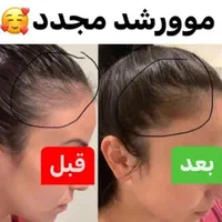 محلول گیاهی ضد ریزش مو و رویش مجدد|آرایشی، بهداشتی، درمانی|شیراز, بهارستان|دیوار