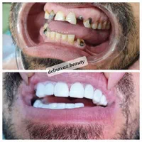 کامپوزیت دندان ژل و بوتاکس پی آرپی و لیفت نخ|خدمات آرایشگری و زیبایی|اهواز, نادری|دیوار