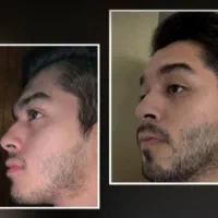 ورزش کن با ریشای بلند و پرپشت
