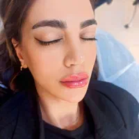 تخفیف ویژه زیبا جویان ژل ۴۰۰بوتاکس۳۰۰فقط یک هفته|خدمات آرایشگری و زیبایی|اصفهان, شهشهان|دیوار