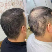 مو نداری پیام بده