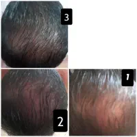 مشاور پوست و مو رایگان