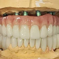 لابراتوار دندانسازی نیکامهر|خدمات زیبایی و سلامت|تهران, کرمان|دیوار