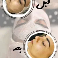 پاکسازی پوست شیراز|خدمات آرایشگری و زیبایی|شیراز, شهرک فرهنگیان|دیوار