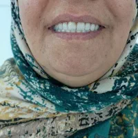 لابراتوار دندان سازی سلامت|خدمات آرایشگری و زیبایی|نیشابور, شریعتی|دیوار