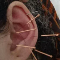 طب سوزنی بادکش گرم مشاوره تغذیه حجامت عام زالو|خدمات آرایشگری و زیبایی|اصفهان, ملکشهر|دیوار