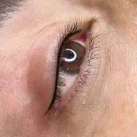 میکرو بلیدینگ و میکرو پیگمنتیشن