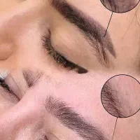 لیزر تاتو ابرو 500