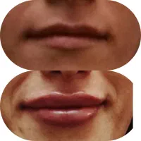 خدمات زیبایی توسط پزشک متخصص