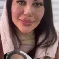 پزشک متخصص ژل و بوتاکس لیفت بانخ افزایش سایزآلت|خدمات آرایشگری و زیبایی|قم, صفائیه|دیوار