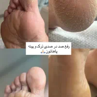 ۱ نفر ظرفیت برای کفسابی یا ژلیش یکشنبه|خدمات آرایشگری و زیبایی|رشت, گلباغ نماز|دیوار