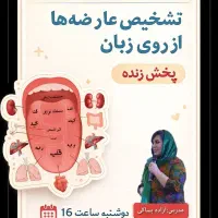 تشخیص عارضه از روی زبان رایگان