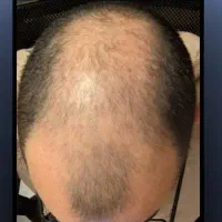 با ما کاشت ممنوع شد